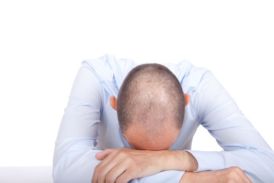 stress menyebabkan botak obati botak genetik pria dengan tricotherapy